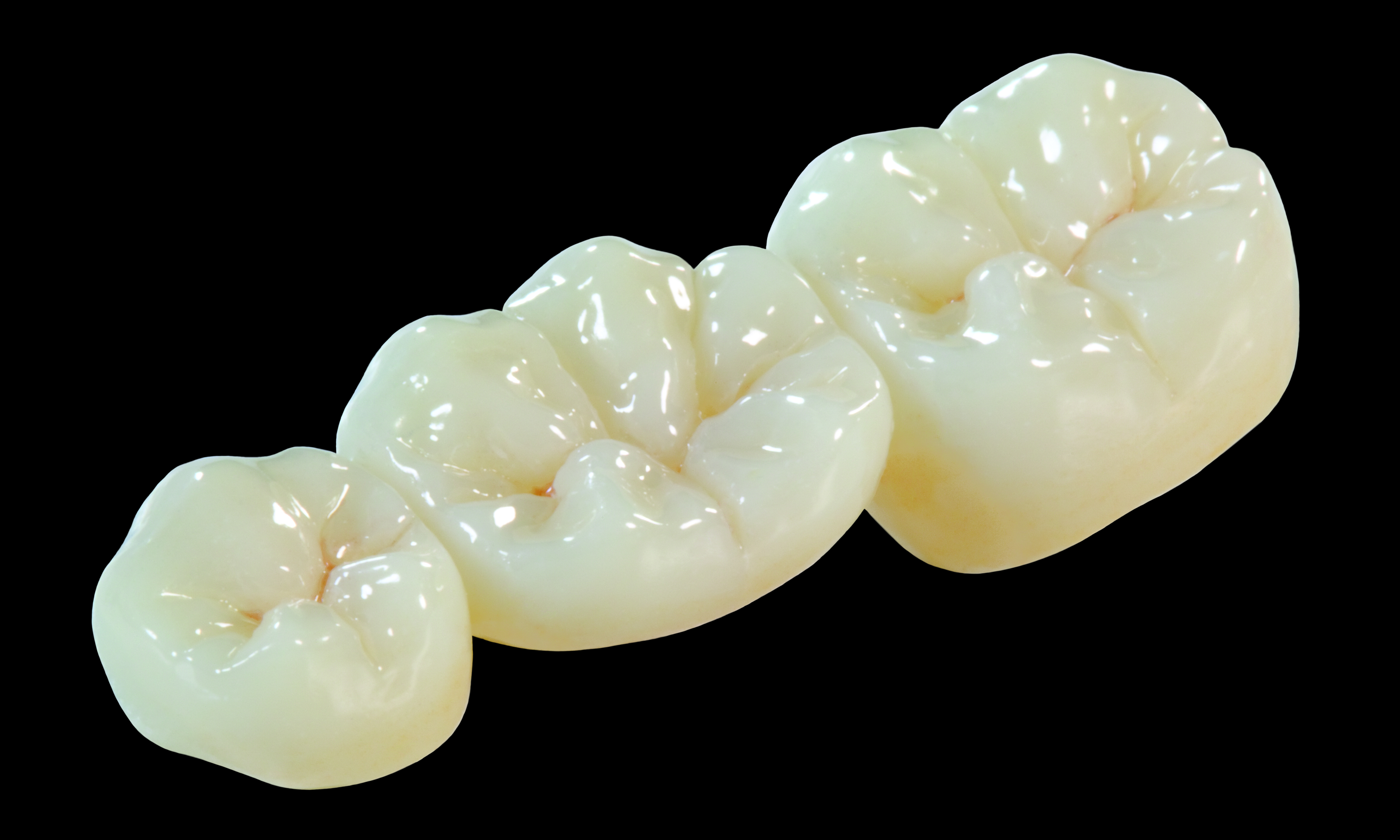 Oral Arts Dental Laboratories' BruxZir Crowns Oral Arts Dental Laboratories